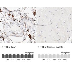 Cathepsin H Antibody, Novus Biologicals:Antibodies:Primary Antibodies